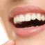 The benefits of brightening your smile with Professional Teeth Whitening