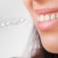 How Your Invisalign Treatment is Impacted By Not Wearing Your Trays As You Should