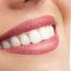 The Many Benefits You Can Expect When You Decide to Whiten Your Smile