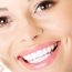 Why Professional Teeth Whitening Is Superior to Home Whitening Options