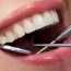 Restore Your Smile’s Esthetic Appeal with Cosmetic Dentistry
