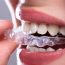 Invisalign Teeth Straightening Treatment