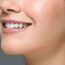 Correcting Cracks, Hiding Stains, and Enhancing Your Smile with Cosmetic Dentistry